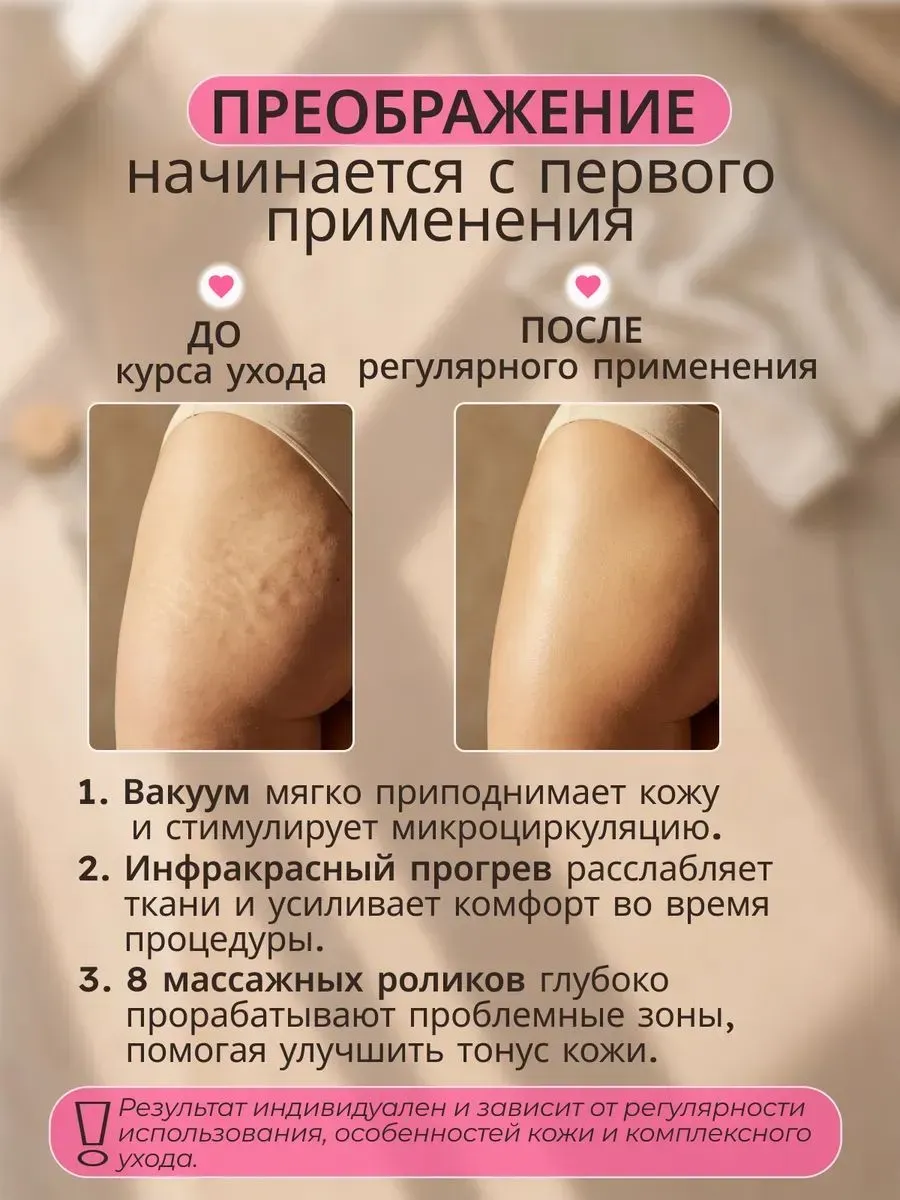 Вакуумный массажер для тела антицеллюлитный — фото 3