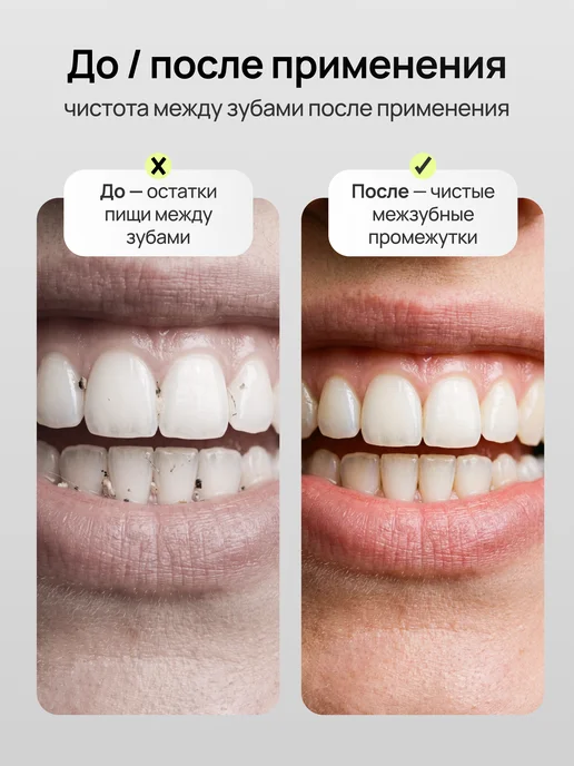 Ирригатор для зубов, белый, фото 2