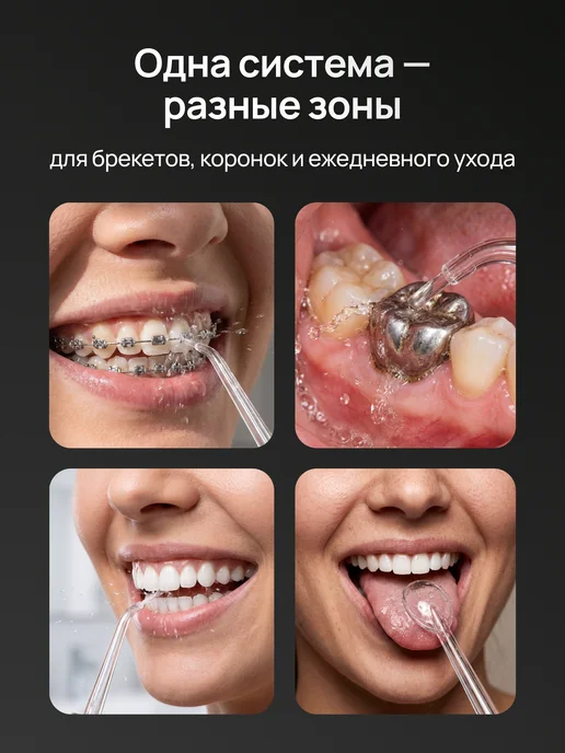 Ирригатор для зубов, белый, фото 3