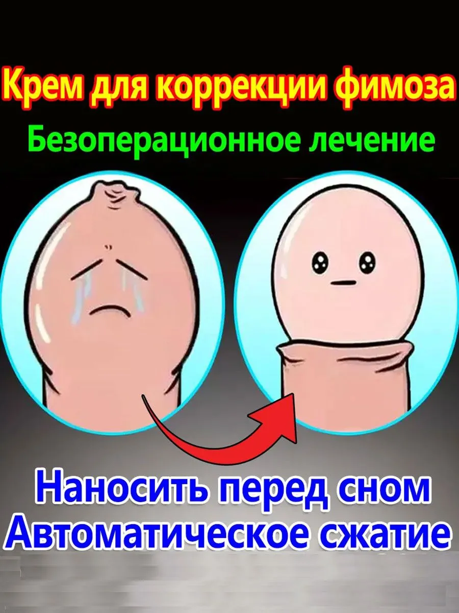 Можно Ли Заниматься Сексом С Фимозом Можно Ли Заниматься Сексом С Фимозом