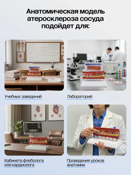 Gran Разборная анатомическая модель атеросклероза сосуда, вариант, фото 2