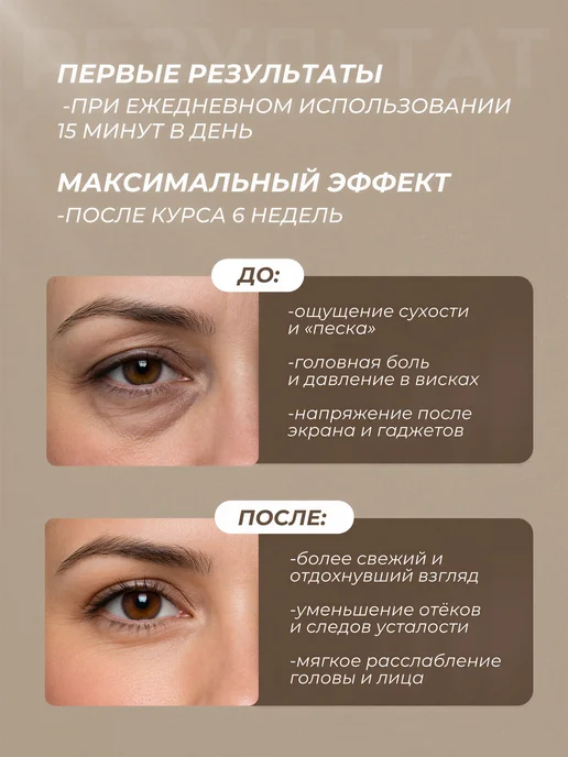 INTREX Электрический массажер для глаз с подогревом от отеков, белый, фото 7